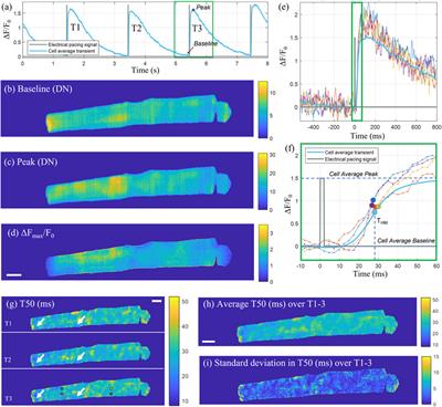 High-speed 2D light-sheet fluorescence microscopy enables quantification of spatially varying calcium dynamics in ventricular cardiomyocytes